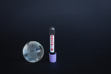 Coronavirus 2019-nCoV Blood Sample. Corona virus outbreaking. Epidemic virus Respiratory Syndrome....