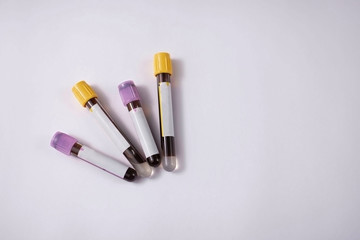 Blood Sample in a flask for analyzing Corona virus and producing vaccine. Corona virus outbreaking.