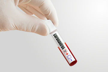 Obraz premium Positive coronavirus test. Virus outbreak around the world