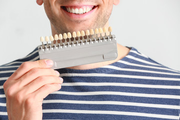 Handsome young man with teeth color samples on white background, closeup