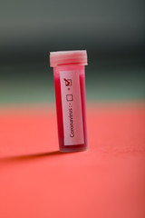 Positive COVID-19 test and laboratory sample of blood testing