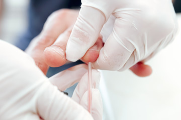 A blood test is a laboratory analysis performed on a blood sample that is usually extracted from a...