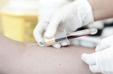 A blood test is a laboratory analysis performed on a blood sample that is usually extracted from a vein in the arm using a hypodermic needle, or via fingerprick. Modern hospital hematology laboratory.
