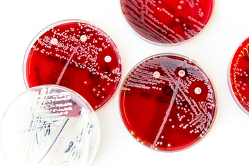 Petri dishes with coronavir isolated, covid-19 drug research