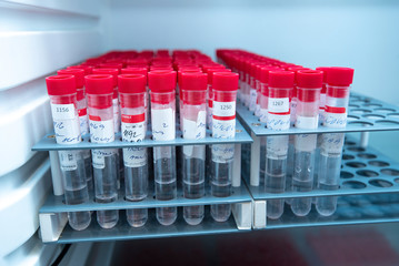 Laboratory test tubes with human DNA samples or coronavirus test material