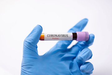 Blood Sample in a flask for analyzing Corona virus and producing vaccine. Corona virus outbreaking.
