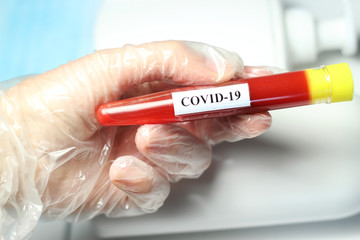 Coronavirus blood test and hygienic items