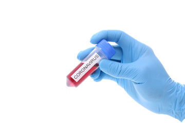 Obraz premium Coronavirus 2019-nCoV Blood Sample. Corona virus outbreaking. Epidemic virus Respiratory Syndrome.