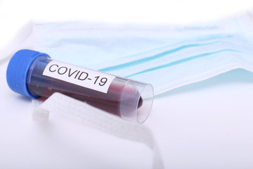 Coronavirus 2019-nCoV Blood Sample. Corona virus outbreaking. Epidemic virus Respiratory Syndrome.