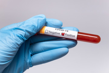 Obraz premium Blood positive test to coronavirus. Medical reseach, test-tube with blood, hand in latex medical gloves. Coronavirus outbreak and influenza. 2019-nCoV, covid-19, sars. High quality photo.