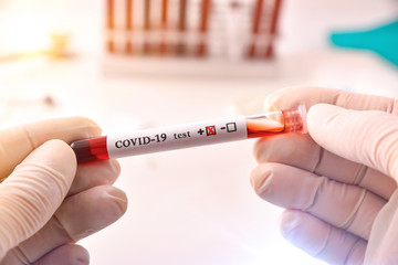 Fototapeta premium Hands taking tube with blood sample infected covid-19 in laboratory