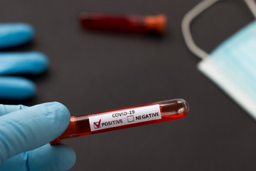 Obraz premium blood test tube to examine the corona virus
