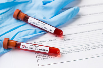Obraz premium blood test tube to examine the corona virus