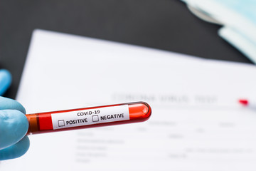 blood test tube to examine the corona virus