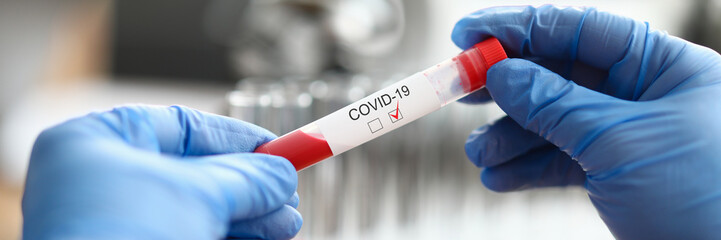 Male chemist hand hold vial with red blood liquid closeup background. Coronavirus COVID 2019 drug...