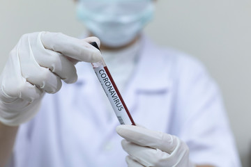 Blood research scientist,Detail of coronavirus test sample,coronavirus