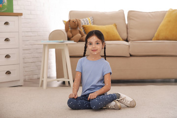 Adorable little girl with chickenpox at home