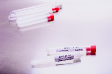 Laboratory test to detect covid-19, isolated test tubes with information from patients infected with the virus.