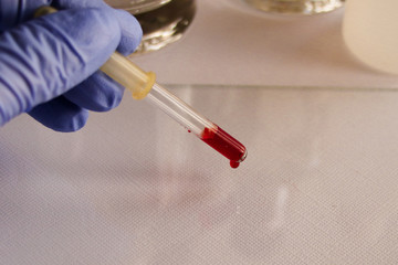 Blood test. Blood tests for the virus.