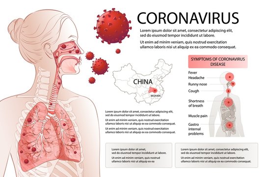 Human MERS-Cov symptoms risk factors. Virus outbreak spread pandemic.