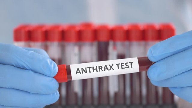 Laboratory assistant wearing protection gloves holds vial with anthrax test