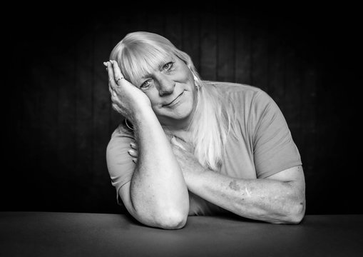 Black And White Trans Woman With Head Resting On Her Hand