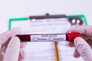 Woman hand holding the test tube with blood sample for COVID-19 test. Coronavirus or Covid-19...