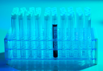 Laboratory tube with blood and virus. Scientific lab close-up. Pandemic disease, healthcare, vaccine research and coronavirus covid-19 test.