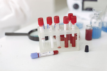 Coronavirus testing samples with bottles solutions inside and a loupe on a table