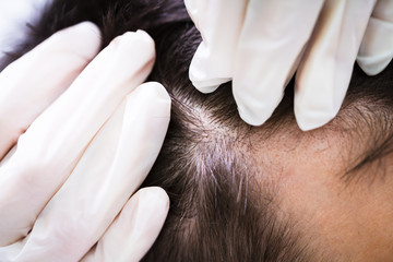 Dermatologist Checking Patient's Hair