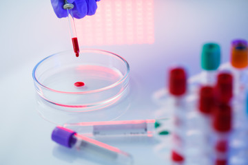 A medical professional, laboratory assistant, doctor performs an analysis in a laboratory, uses...