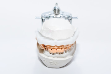 Plaster Cast of jaws. Dental casting gypsum model human Jaws in prosthetic laboratory. Dentistry, Orthodontics. Close up. selective focus