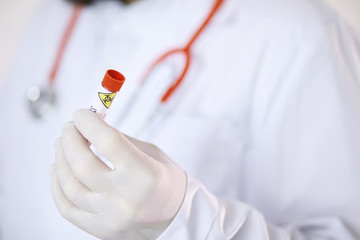 A scientist researcher in the laboratory is testing drugs for the treatment of viral pneumonia. Coronovirus blood test of infected patients. World pandemic.