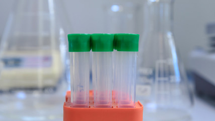 Test tubes, flask and bioscience laboratory instruments. Concept of science, laboratory and study of diseases. Coronavirus (COVID-19) treatment developing.