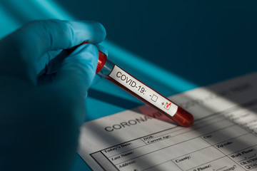 Positive blood test result for the new rapidly spreading Coronavirus