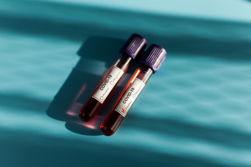 Positive blood test result for the new rapidly spreading Coronavirus