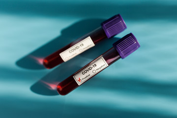 Obraz premium Positive blood test result for the new rapidly spreading Coronavirus