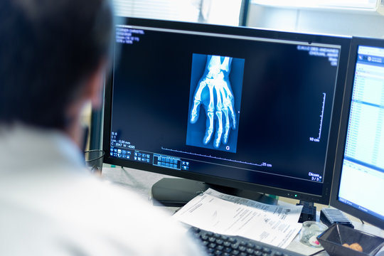 Radiographie de la main m&eacute;decin radiologue diagnostic examen imagerie m&eacute;dicale