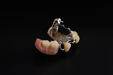 Dental appliances and dental prostheses.
