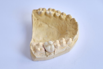 Dental appliances and dental prostheses.