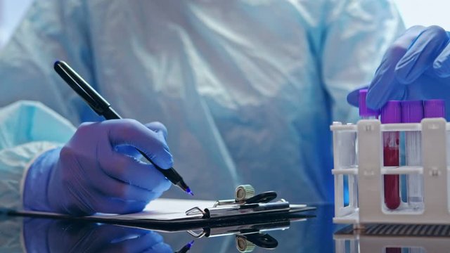 MERS epidemic. Medical diagnostics. Doctor in gloves recording blood test results.
