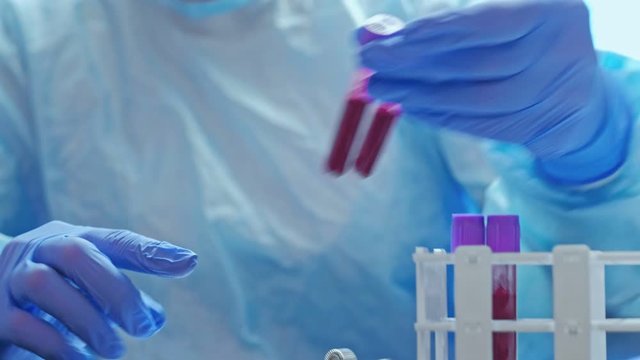 Coronavirus disease. Laboratory analysis. Nurse in protective gloves studying blood samples.