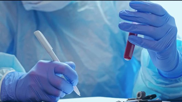 Coronavirus epidemic. Laboratory test. Nurse in gloves studying blood sample recording results.