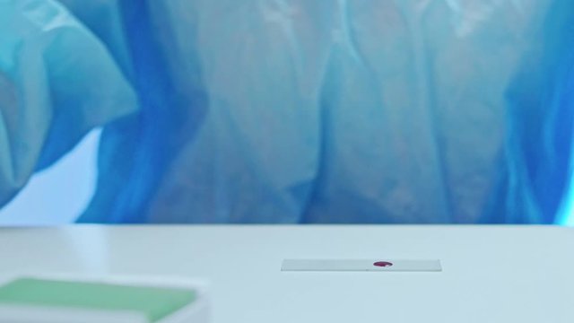 Covid-19 vaccine. Clinical research. Nurse checking blood sample reaction with glass dropper.