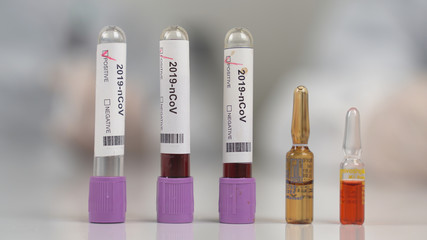 Coronavirus test tubes, flasks in laboratory with scientist background.