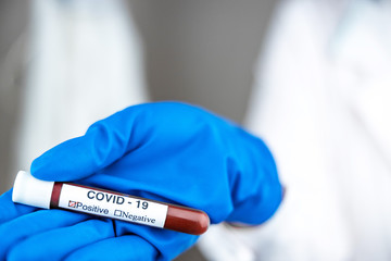 A nurse s hand in a glove holds a test tube with the inscription COVID 19, with a positive blood test for a new rapidly spreading coronavirus, close-up, shallow depth of field, selective focus