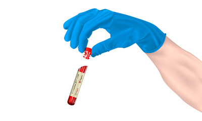 Realistic test tube in hand with a coronavirus test (2019-nCOV) on a isolated background, concept of a negative result on COVID-2019, vector illustration
