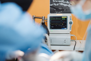 Monitor showing vital signs during the procedure.
