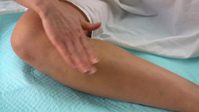 woman smears her foot with cream. Cream for legs with varicose veins