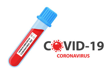 Test tubes that collect blood samples from Chinese patients infected with the corona virus